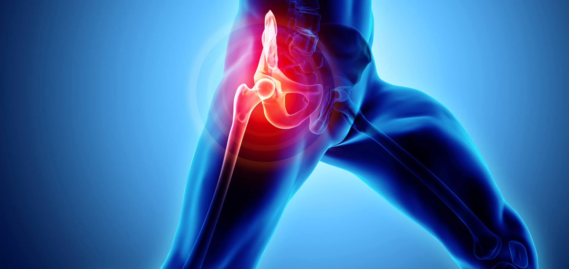 Saksham Ayurveda - A Natural Approach to Avascular Necrosis (AVN) Exploring Ayurveda's Potential